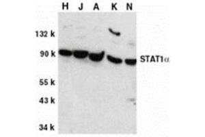 Western blot analysis of STAT1 alpha in whole cell lysates from HeLa (H), Jurkat (J), A431 (A), K562 (K), and NIH3T3 (N) cells, with this product at 1 μg/ml.