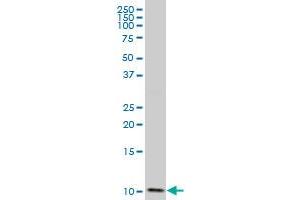 DYNLL2 polyclonal antibody (A01), Lot # 060516JCS1 Western Blot analysis of DYNLL2 expression in SJCRH30 .