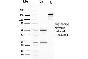 SDS-PAGE Analysis Purified Insulin Mouse Monoclonal Antibody (2D11-H5). (Insulin anticorps)
