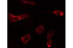 ABIN6275047 staining MCF7 cells by IF/ICC. (NT5C1A anticorps  (Internal Region))