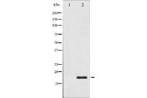 Western blot analysis of Acetyl-Histone H3 phosphorylation expression in TSA treated RAW264.