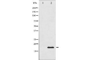 Western blot analysis of Acetyl-Histone H3 phosphorylation expression in TSA treated RAW264. (Histone 3 anticorps  (H3K9ac))