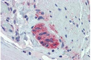 Human Small Intestine, Myenteric Plexus: Formalin-Fixed, Paraffin-Embedded (FFPE)