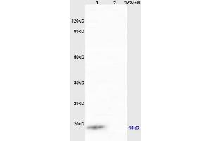 Lane 1: human colon carcinoma lysates Lane 2: mouse intestine lysates probed with Anti IQCJ Polyclonal Antibody, Unconjugated (ABIN1387803) at 1:200 in 4 °C. (IQCJ anticorps  (AA 47-67))