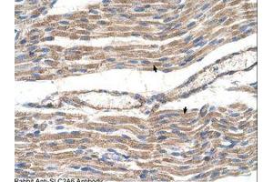 Image no. 1 for anti-Solute Carrier Family 2 (Facilitated Glucose Transporter), Member 6 (SLC2A6) (AA 351-400) antibody (ABIN205018)