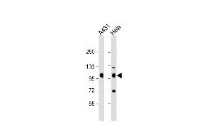 All lanes : Anti-IGF1 Receptor (IGF1R) Antibody (C-term) at 1:2000 dilution Lane 1: A431 whole cell lysate Lane 2: Hela whole cell lysate Lysates/proteins at 20 μg per lane.