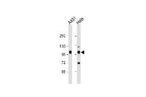 All lanes : Anti-IGF1 Receptor (IGF1R) Antibody (C-term) at 1:2000 dilution Lane 1: A431 whole cell lysate Lane 2: Hela whole cell lysate Lysates/proteins at 20 μg per lane. (IGF1R anticorps  (C-Term))