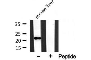 Western blot analysis of extracts from mouse liver, using BST2 antibody. (BST2 anticorps  (Internal Region))