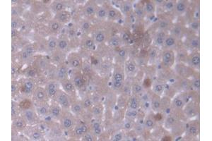 DAB staining on IHC-P; Samples: Mouse Liver Tissue (GCDH anticorps  (AA 270-438))