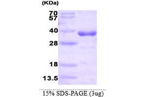 SDS-PAGE (SDS) image for Histamine N-Methyltransferase (HNMT) (AA 1-292) protein (His tag) (ABIN667093) (HNMT Protein (AA 1-292) (His tag))