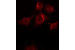 ABIN6268794 staining Hela by IF/ICC. (EPH Receptor B2 anticorps  (C-Term))