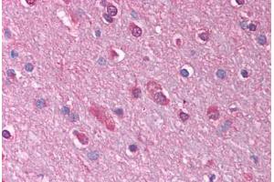 anti-gamma-aminobutyric Acid (GABA) Receptor, theta (GABRQ) (AA 31-80) antibody