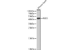 RGS5 anticorps  (AA 1-181)