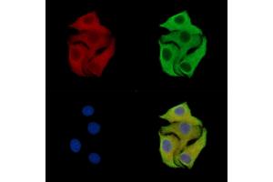 anti-Coiled-Coil Domain Containing 43 (CCDC43) antibody