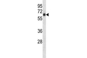 S6k1 antibody western blot analysis in mouse heart tissue lysate.