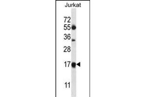MRPL41 Antibody (N-term) (ABIN657049 and ABIN2846216) western blot analysis in Jurkat cell line lysates (35 μg/lane).
