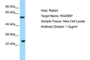 Host: RabbitTarget Name: RGS9BPAntibody Dilution: 1.