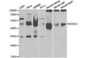 Western blot analysis of extracts of various cell lines, using NDRG1 antibody. (NDRG1 anticorps  (AA 175-394))
