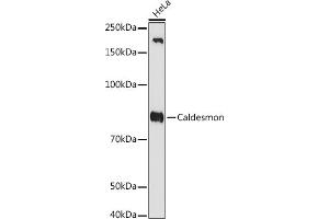 Western blot analysis of extracts of HeLa cells, using Caldesmon antibody (ABIN7266024) at 1:1000 dilution. (Caldesmon anticorps)