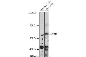 Western blot analysis of extracts of various cell lines, using MITF Rabbit mAb (ABIN7268511) at 1:1000 dilution.