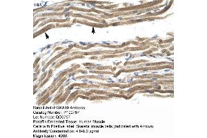 Human Muscle (HOXA10 anticorps  (N-Term))