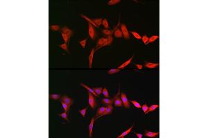 Immunofluorescence analysis of NIH-3T3 cells using TRIM31 Rabbit pAb (ABIN7270987) at dilution of 1:200 (40x lens). (TRIM31 anticorps  (AA 186-425))