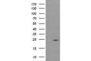 Image no. 2 for anti-RAB37, Member RAS Oncogene Family (RAB37) antibody (ABIN1500565) (RAB37 anticorps)