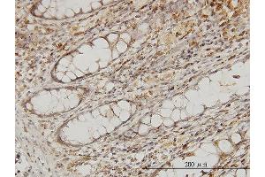 Immunoperoxidase of monoclonal antibody to MAPRE2 on formalin-fixed paraffin-embedded human colon.