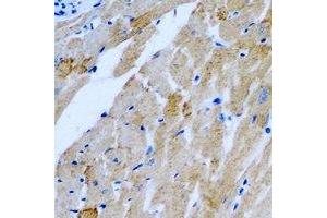 Immunohistochemical analysis of TTLL12 staining in rat heart formalin fixed paraffin embedded tissue section. (TTLL12 anticorps)