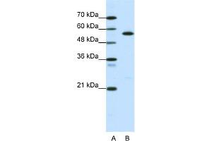 WB Suggested Anti-CORO1A Antibody Titration:  0. (Coronin 1a anticorps  (Middle Region))