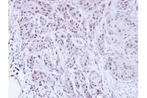 IHC-P Image Immunohistochemical analysis of paraffin-embedded Cal27 xenograft, using SCMH1, antibody at 1:100 dilution. (SCMH1 anticorps  (Center))