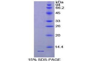 SDS-PAGE (SDS) image for Parathyroid Hormone (PTH) (AA 32-119) protein (His tag) (ABIN1080449)