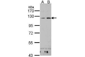 WB Image Sample(30 ug whole cell lysate) A:H1299 B:Hep G2 , 7. (CD11c anticorps  (N-Term))