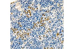 Immunohistochemistry of paraffin embedded mouse spleen using ANXA3 (ABIN7073065) at dilution of 1: 200 (400x lens)