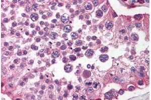 Human Testis (formalin-fixed, paraffin-embedded) stained with SIRPA antibody ABIN214476 at 2. (SIRPA anticorps  (C-Term))