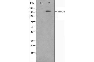 Western blot analysis on Jurkat cell lysate using TOP2B Antibody. (TOP2B anticorps  (N-Term))