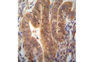 Immunohistochemistry analysis in formalin fixed and paraffin embedded human uterus tissue reacted with KIAA1644 antibody (N-term) followed which was peroxidase conjugated to the secondary antibody and followed by DAB staining. (SHISAL1/KIAA1644 anticorps  (N-Term))