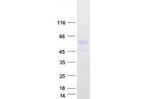 Validation with Western Blot