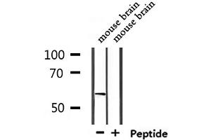 Western blot analysis of extracts from mouse brain, using USP17L Antibody. (USP17L9P anticorps)