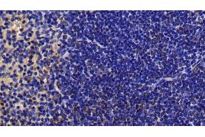 Detection of MAP2K7 in Mouse Spleen Tissue using Polyclonal Antibody to Mitogen Activated Protein Kinase Kinase 7 (MAP2K7)