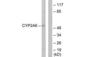 Western blot analysis of extracts from Jurkat cells, using Cytochrome P450 2A6 antibody.