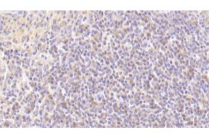 Detection of MAP2K7 in Human Spleen Tissue using Polyclonal Antibody to Mitogen Activated Protein Kinase Kinase 7 (MAP2K7)