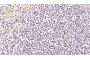 Detection of MAP2K7 in Human Spleen Tissue using Polyclonal Antibody to Mitogen Activated Protein Kinase Kinase 7 (MAP2K7) (MAP2K7 anticorps  (AA 113-388))