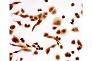 anti-T-Complex 1 (TCP1) (AA 82-98) antibody