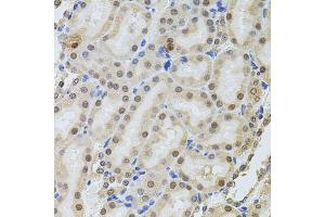 Immunohistochemistry of paraffin-embedded rat kidney using POP4 antibody (ABIN6128482, ABIN6145964, ABIN6145966 and ABIN6220640) at dilution of 1:100 (40x lens). (RPP29 anticorps  (AA 1-220))