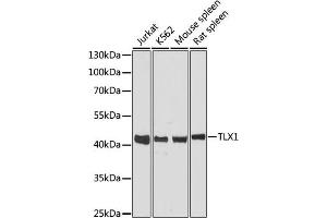 Western blot analysis of extracts of various cell lines, using TLX1 antibody (ABIN6131789, ABIN6149229, ABIN6149230 and ABIN6216643) at 1:3000 dilution. (TLX1 anticorps  (AA 1-190))