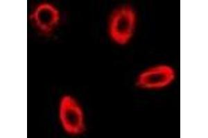 Immunofluorescent analysis of FBP1 staining in MCF7 cells. (FBP1 anticorps)