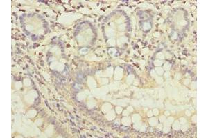 Immunohistochemistry of paraffin-embedded human small intestine tissue using ABIN7165370 at dilution of 1:100