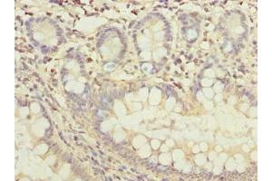 Immunohistochemistry of paraffin-embedded human small intestine tissue using ABIN7165370 at dilution of 1:100 (FAM118B anticorps  (AA 83-351))