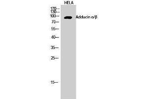 Western Blotting (WB) image for anti-Adducin alpha/beta (Lys5) antibody (ABIN3173689) (Adducin alpha/beta (Lys5) anticorps)